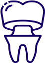 Dental Crowns