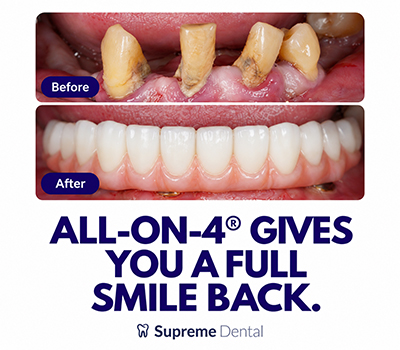 Supreme Dental Offer